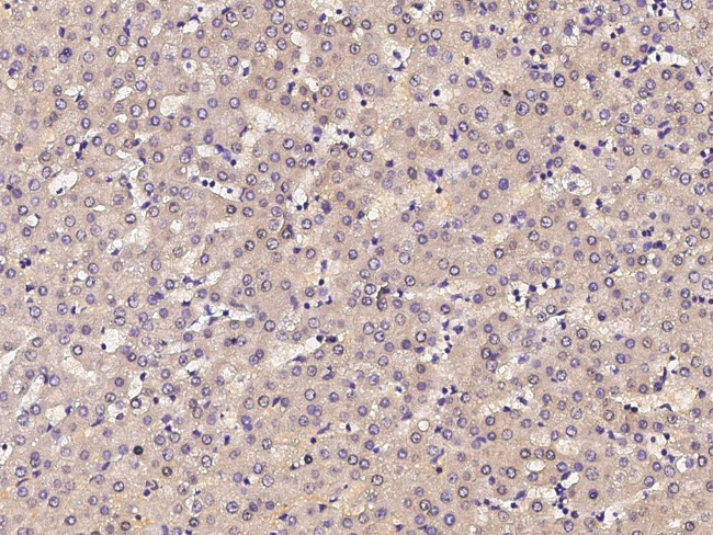 PIK3CG Antibody in Immunohistochemistry (Paraffin) (IHC (P))