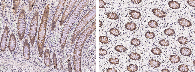 RAB5 Antibody in Immunohistochemistry (Paraffin) (IHC (P))