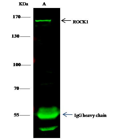 ROCK1 Antibody in Immunoprecipitation (IP)