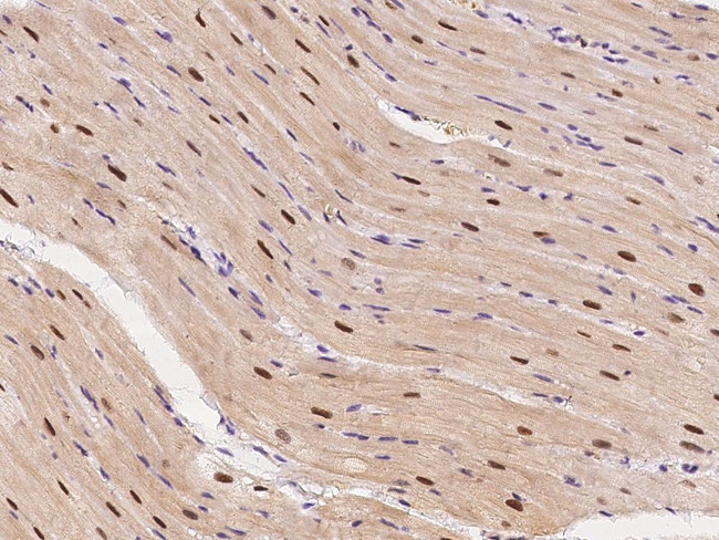 ECD Antibody in Immunohistochemistry (Paraffin) (IHC (P))