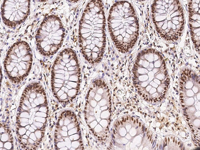 ECD Antibody in Immunohistochemistry (Paraffin) (IHC (P))