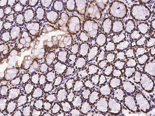 ECD Antibody in Immunohistochemistry (Paraffin) (IHC (P))