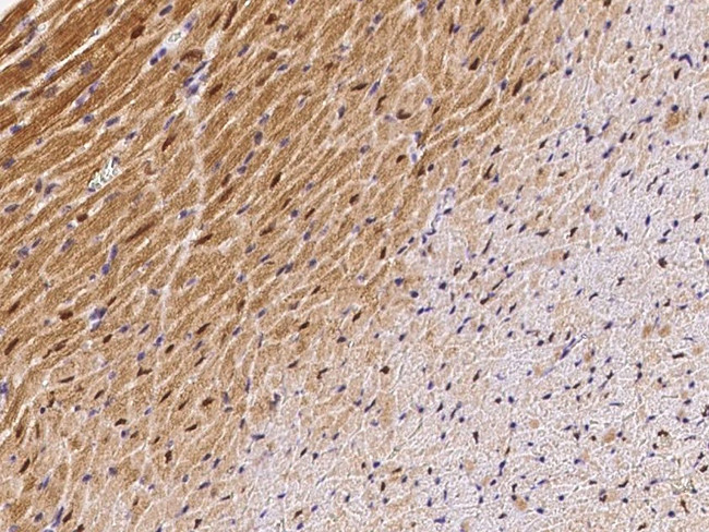 ECD Antibody in Immunohistochemistry (Paraffin) (IHC (P))