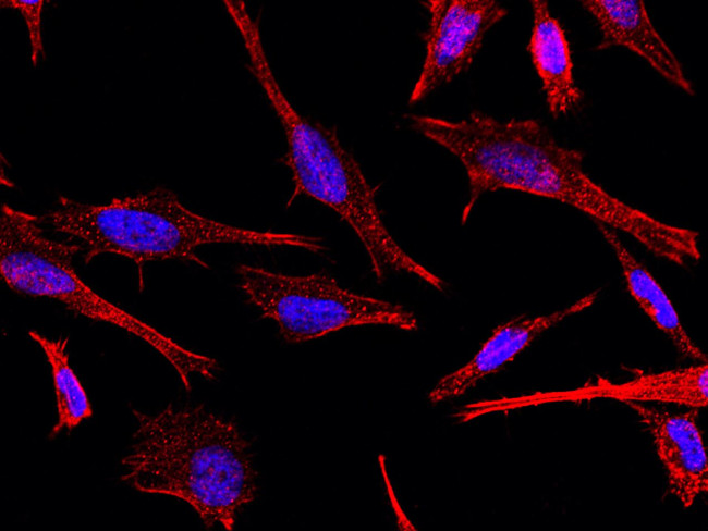 TAGLN Antibody in Immunocytochemistry (ICC/IF)