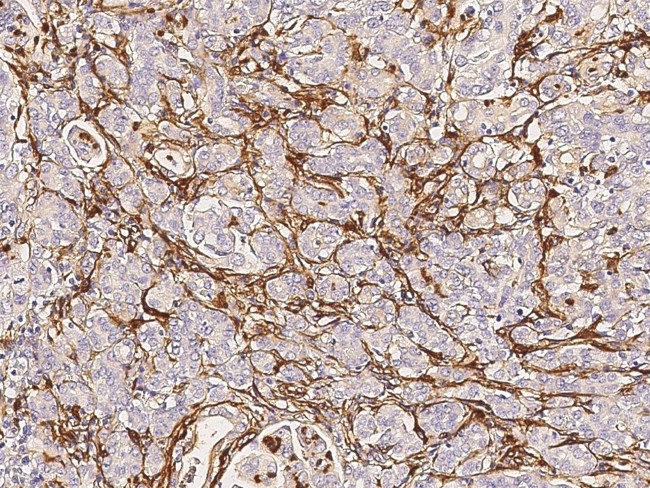 TAGLN Antibody in Immunohistochemistry (Paraffin) (IHC (P))