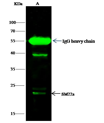 TAGLN Antibody in Immunoprecipitation (IP)