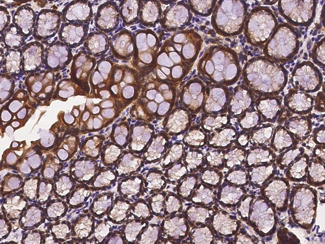 Profilin 1 Antibody in Immunohistochemistry (Paraffin) (IHC (P))