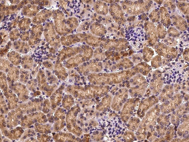 Profilin 1 Antibody in Immunohistochemistry (Paraffin) (IHC (P))