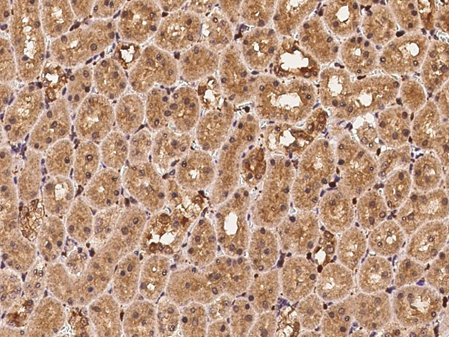 Profilin 1 Antibody in Immunohistochemistry (Paraffin) (IHC (P))