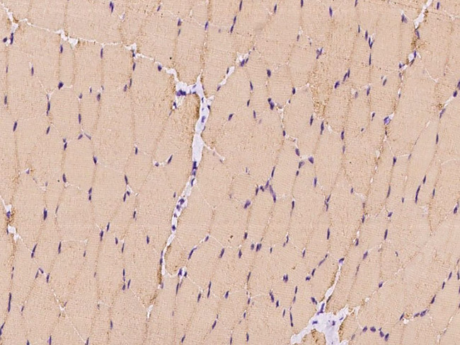 c-Raf Antibody in Immunohistochemistry (Paraffin) (IHC (P))