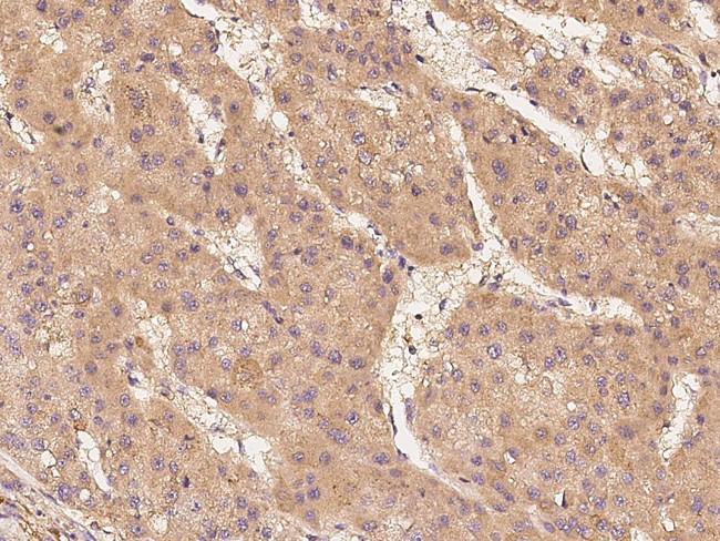 c-Raf Antibody in Immunohistochemistry (Paraffin) (IHC (P))