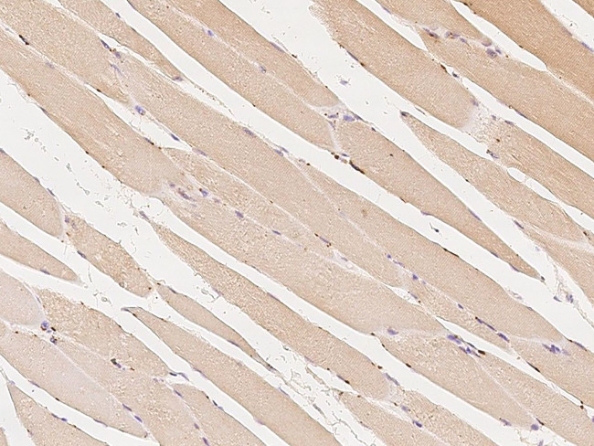 c-Raf Antibody in Immunohistochemistry (Paraffin) (IHC (P))