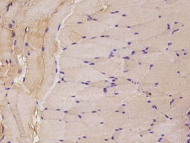 c-Raf Antibody in Immunohistochemistry (Paraffin) (IHC (P))