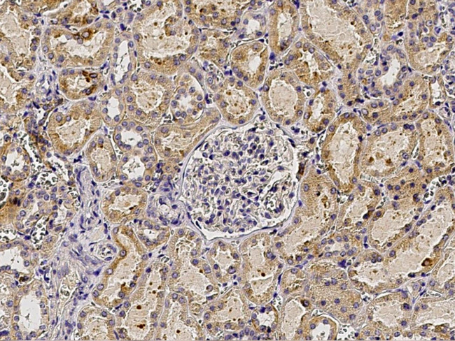 CD264 (TRAIL-R4) Antibody in Immunohistochemistry (Paraffin) (IHC (P))