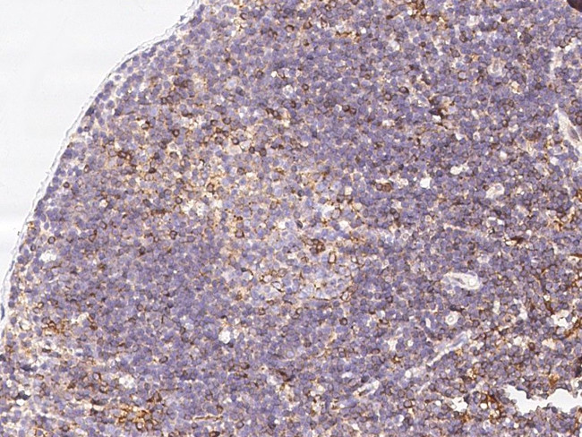 beta-2 Microglobulin Antibody in Immunohistochemistry (Paraffin) (IHC (P))