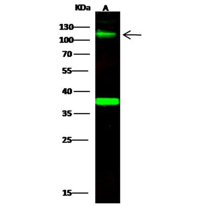 B7-H3 Antibody in Western Blot (WB)