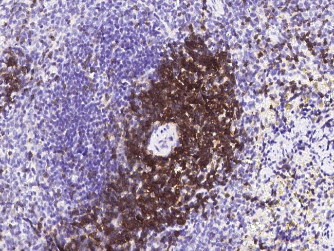 CD6 Antibody in Immunohistochemistry (Paraffin) (IHC (P))