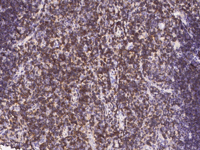 CD6 Antibody in Immunohistochemistry (Paraffin) (IHC (P))