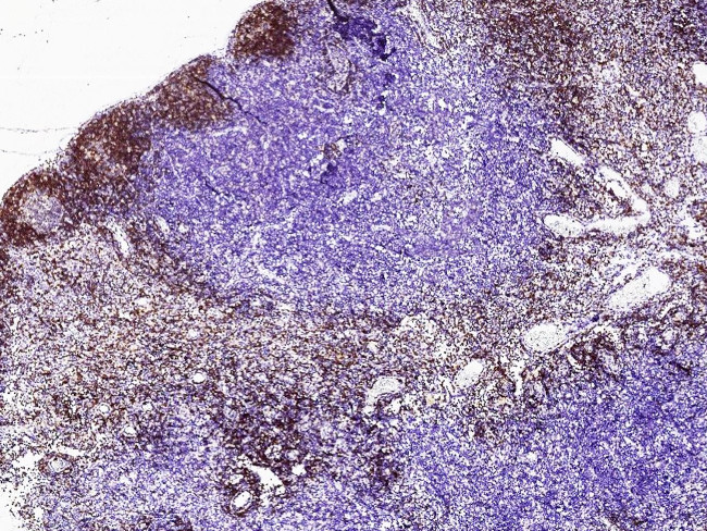 CD79b Antibody in Immunohistochemistry (Paraffin) (IHC (P))