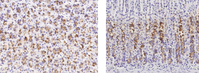 Layilin Antibody in Immunohistochemistry (Paraffin) (IHC (P))