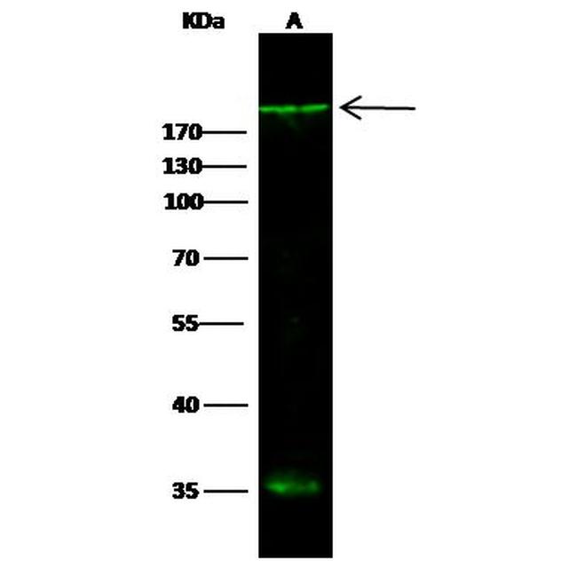 LIFR Antibody in Western Blot (WB)