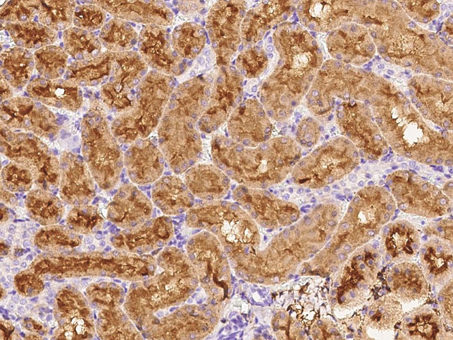 CD73 Antibody in Immunohistochemistry (Paraffin) (IHC (P))