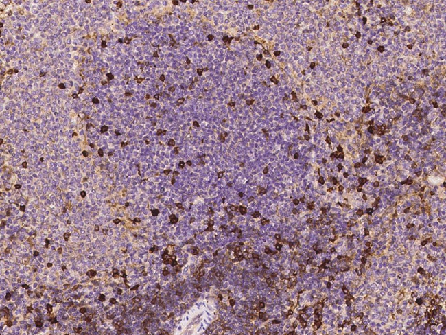 CD73 Antibody in Immunohistochemistry (Paraffin) (IHC (P))