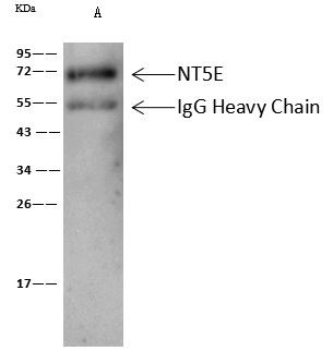 CD73 Antibody in Immunoprecipitation (IP)