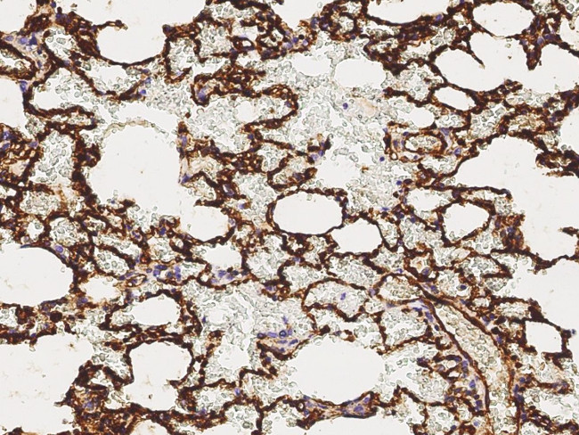 Thrombomodulin Antibody in Immunohistochemistry (Paraffin) (IHC (P))