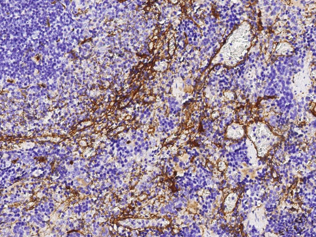 Thrombomodulin Antibody in Immunohistochemistry (Paraffin) (IHC (P))