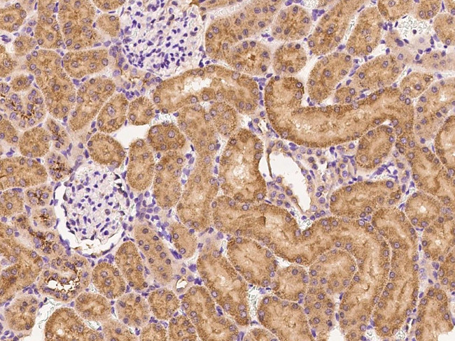 B7-H4 Antibody in Immunohistochemistry (Paraffin) (IHC (P))