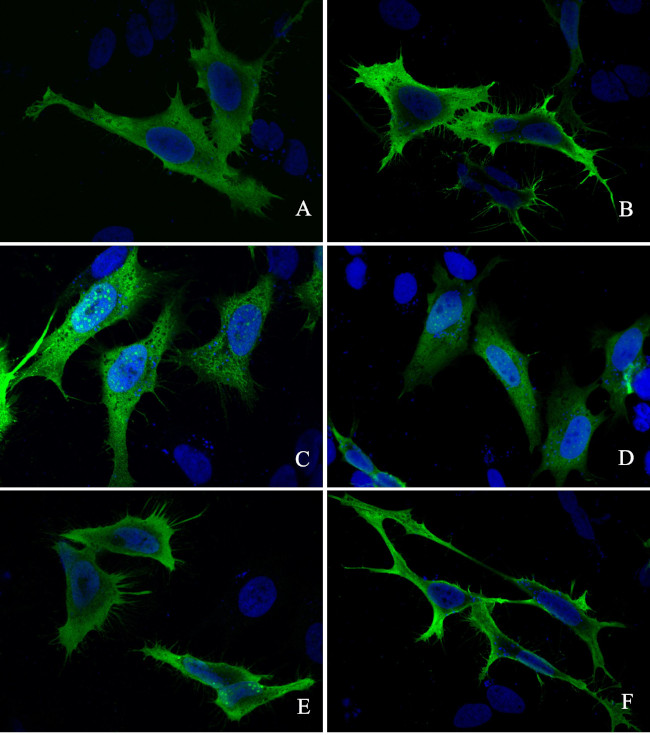 S-peptide Epitope Tag Antibody in Immunocytochemistry (ICC/IF)