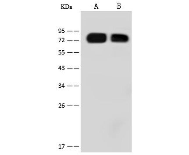 Influenza A H1N1 HA (A/California/04/2009) Antibody in Western Blot (WB)