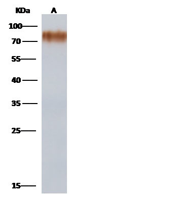 Influenza A H1N1 HA (A/Brevig Mission/1/1918) Antibody in Western Blot (WB)