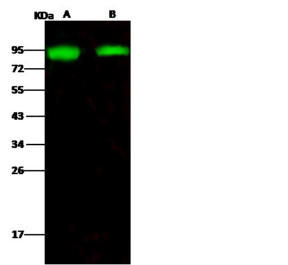 Influenza A H1N1 HA (A/New Caledonia/20/99) Antibody in Western Blot (WB)