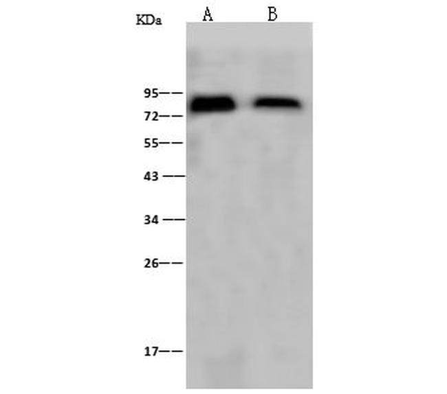 Influenza A H1N1 HA (A/Puerto Rico/8/34) Antibody in Western Blot (WB)