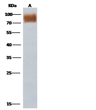 influenza A H3N2 NA (A/Babol/36/2005) Antibody in Western Blot (WB)