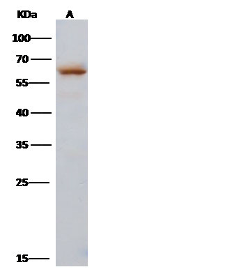 Influenza A H3N2 NP (A/Hong Kong/1/1968) Antibody in Western Blot (WB)