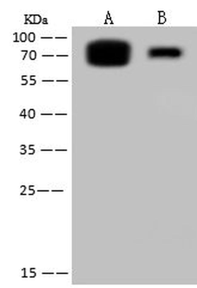 Influenza B NP (B/Florida/4/2006) Antibody in Western Blot (WB)