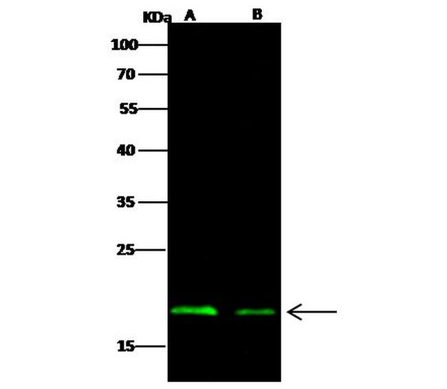 Ebola Virus NP (strain New Guinea 2014) Antibody in Western Blot (WB)