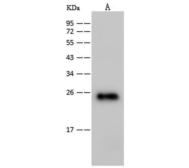 HIV1 p24 (group M, subtype B, strain 92418) Antibody in Western Blot (WB)