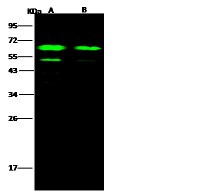 Ebola Virus GP (subtype Sudan, strain Gulu) Antibody in Western Blot (WB)