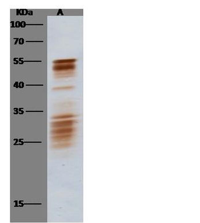 SARS Coronavirus Nucleocapsid Antibody in Western Blot (WB)