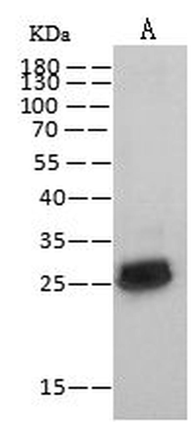 HIV1 p24 (group N, strain 06CM-U14296) Antibody in Western Blot (WB)