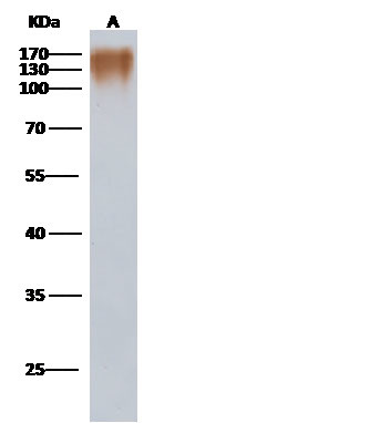 HIV1 gp120 (group P, strain RBF168) Antibody in Western Blot (WB)