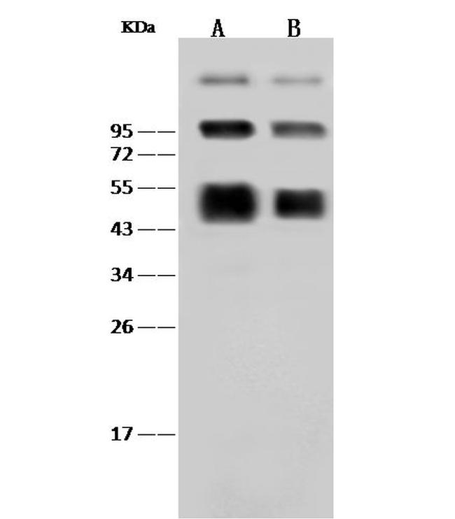 Dengue Virus Type 2 NS1 (strain New Guinea C) Antibody in Western Blot (WB)