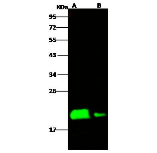 Ebola Virus NP (subtype Zaire, strain H.sapiens-wt/GIN/2014/Kissidougou-C15) Antibody in Western Blot (WB)