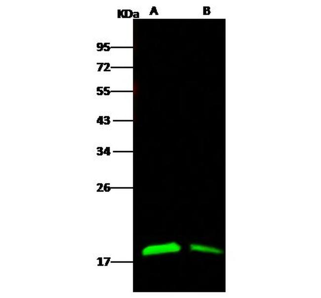 Ebola Virus NP (subtype Zaire, strain H.sapiens-wt/GIN/2014/Kissidougou-C15) Antibody in Western Blot (WB)