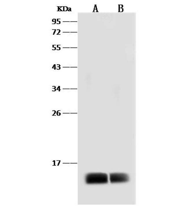 Dengue Virus Type 2 Envelope (strain New Guinea C/PUO-218 hybrid) Antibody in Western Blot (WB)