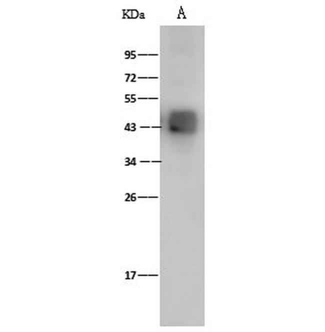 Dengue Virus Type 2 Envelope (strain New Guinea C/PUO-218 hybrid) Antibody in Western Blot (WB)